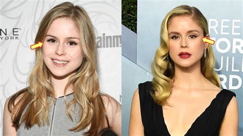 erin moriarty before surgery|Erin Moriarty plastic surgery journey and。